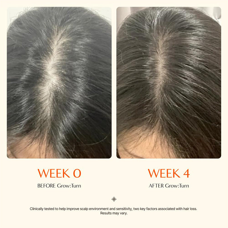 Hair Growth Serum with Massage Brush